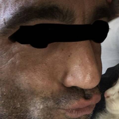 bacio