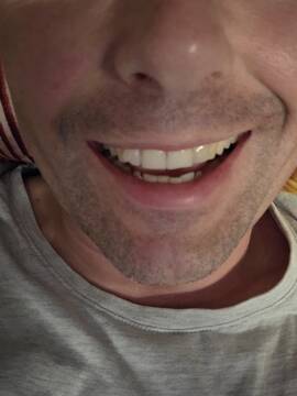Smile